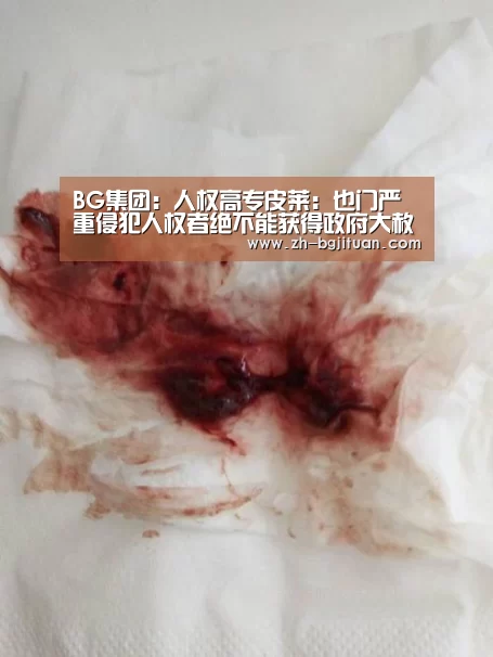 BG集团
